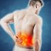 Hernia Types