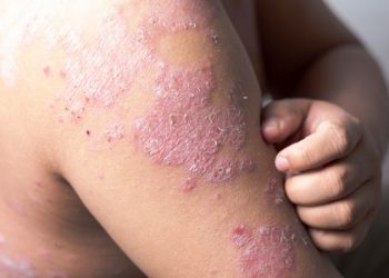 Skin Cancer of the Head and Neck Symptoms