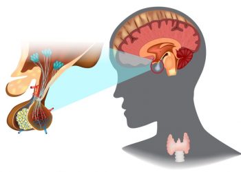 Neuroendocrine Tumors