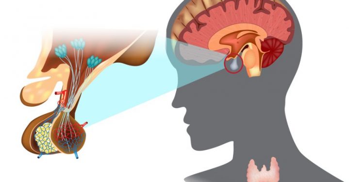 Neuroendocrine Tumors