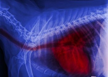 Blastomycosis Symptoms