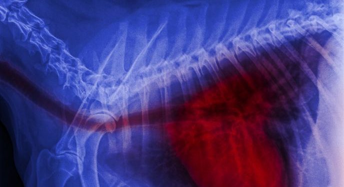 Blastomycosis Symptoms