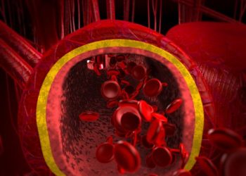 Tumors of the Blood Veins