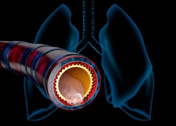 Acute Bronchitis Symptoms