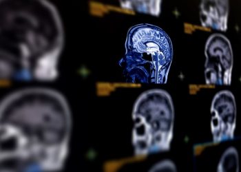 The Management of Skull Base Tumors Symptoms and Treatment