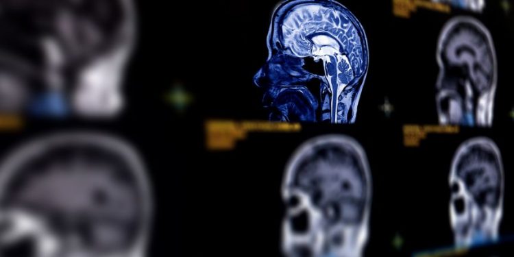 The Management of Skull Base Tumors Symptoms and Treatment