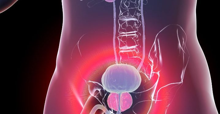 Causes of Male Infertility Symptoms