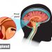 Neuroendocrine Tumors Symptoms