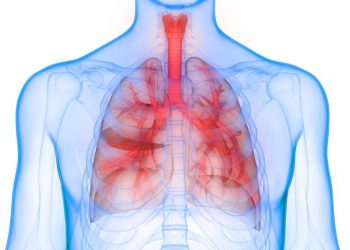 Tumors of the Trachea Symptoms
