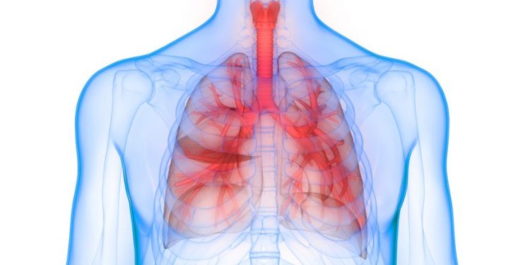 Tumors of the Trachea Symptoms
