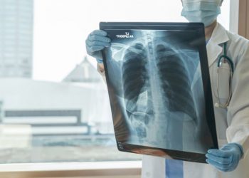 Getting a Handle on Asthma Symptoms