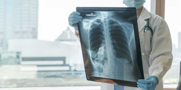 Getting a Handle on Asthma Symptoms