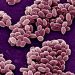 Three Types of Anthrax Symptoms