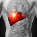 Tumors of the Diaphragm Symptoms