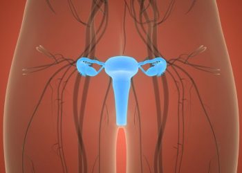 Dysfunctional Uterine Bleeding Symptoms