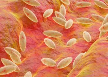 Brucellosis – Symptoms, Causes, and Prevention