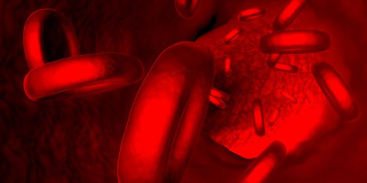 Refractory Anemia Symptoms and Causes