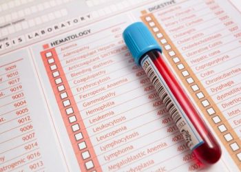 Monoclonal Gammopathy