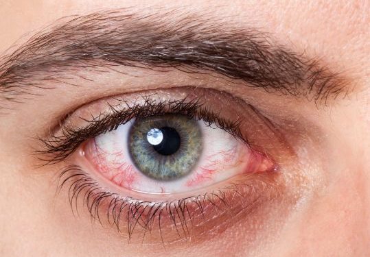 Open Angle Glaucoma Symptoms and Risk Factors