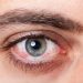 Open Angle Glaucoma Symptoms and Risk Factors
