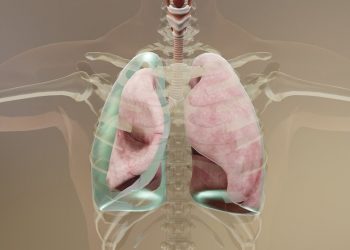 Hemothorax Treatments