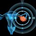 Malignant Ovarian Tumors