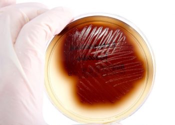 Asymptomatic Bacterial Urinary Tract Infection