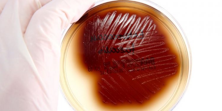 Asymptomatic Bacterial Urinary Tract Infection