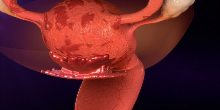 Vulvar Vestibulilitis