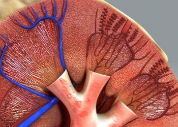 Nephrocalcinosis Symptoms