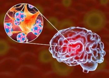 Japanese Encephalitis