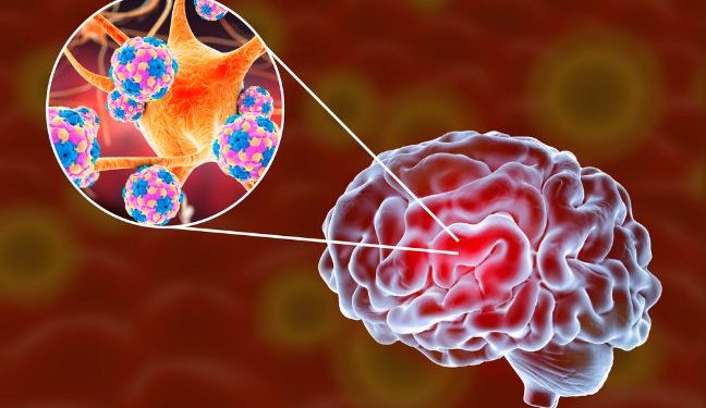 Japanese Encephalitis