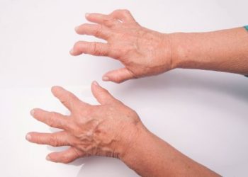 Palindromic Rheumatism