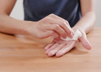 What You Need to Know About Hyperhidrosis