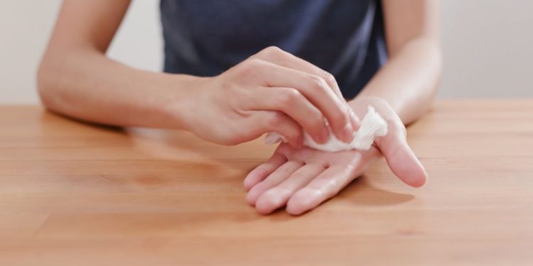 What You Need to Know About Hyperhidrosis