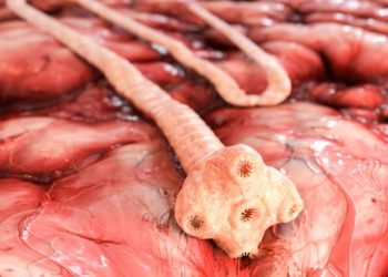 Diphyllobothrium Latum