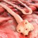Diphyllobothrium Latum