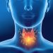 Thyroiditis