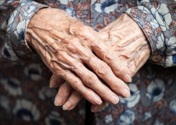 Skin Aging Symptoms and Causes