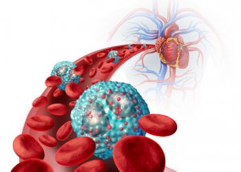 Eosinophilic Pneumonia Symptoms