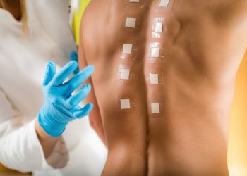 Hypersensitive Tipe Symptoms