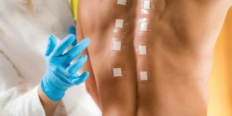 Hypersensitive Tipe Symptoms