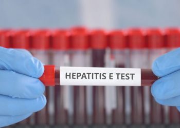 Hepatitis Symptoms and Treatment
