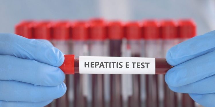 Hepatitis Symptoms and Treatment