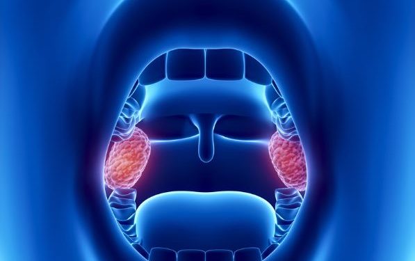 Tonsils Infections Symptoms