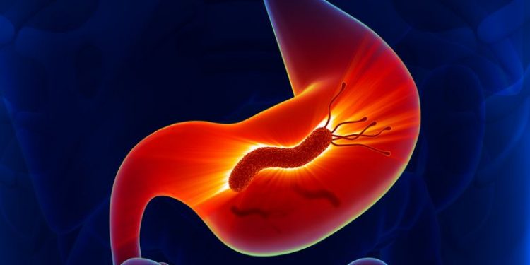 Helicobacter Pylori Symptoms and Treatment
