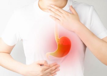 Functional Dyspepsia