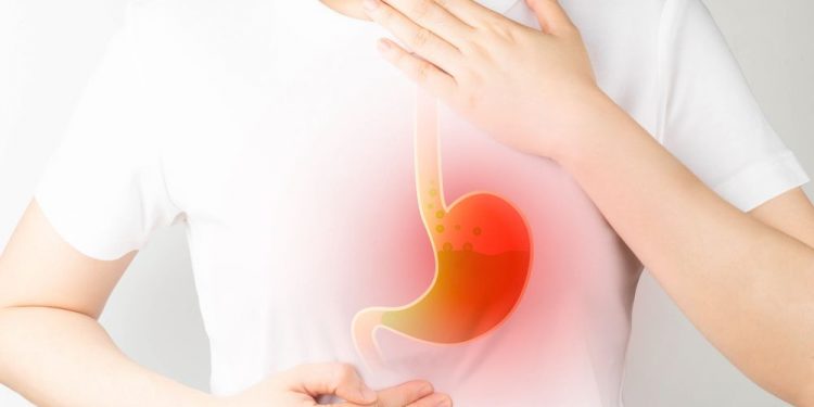 Functional Dyspepsia