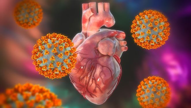 Myocarditis Symptoms