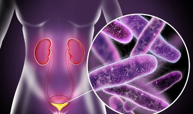 Urethritis Symptoms and Treatment